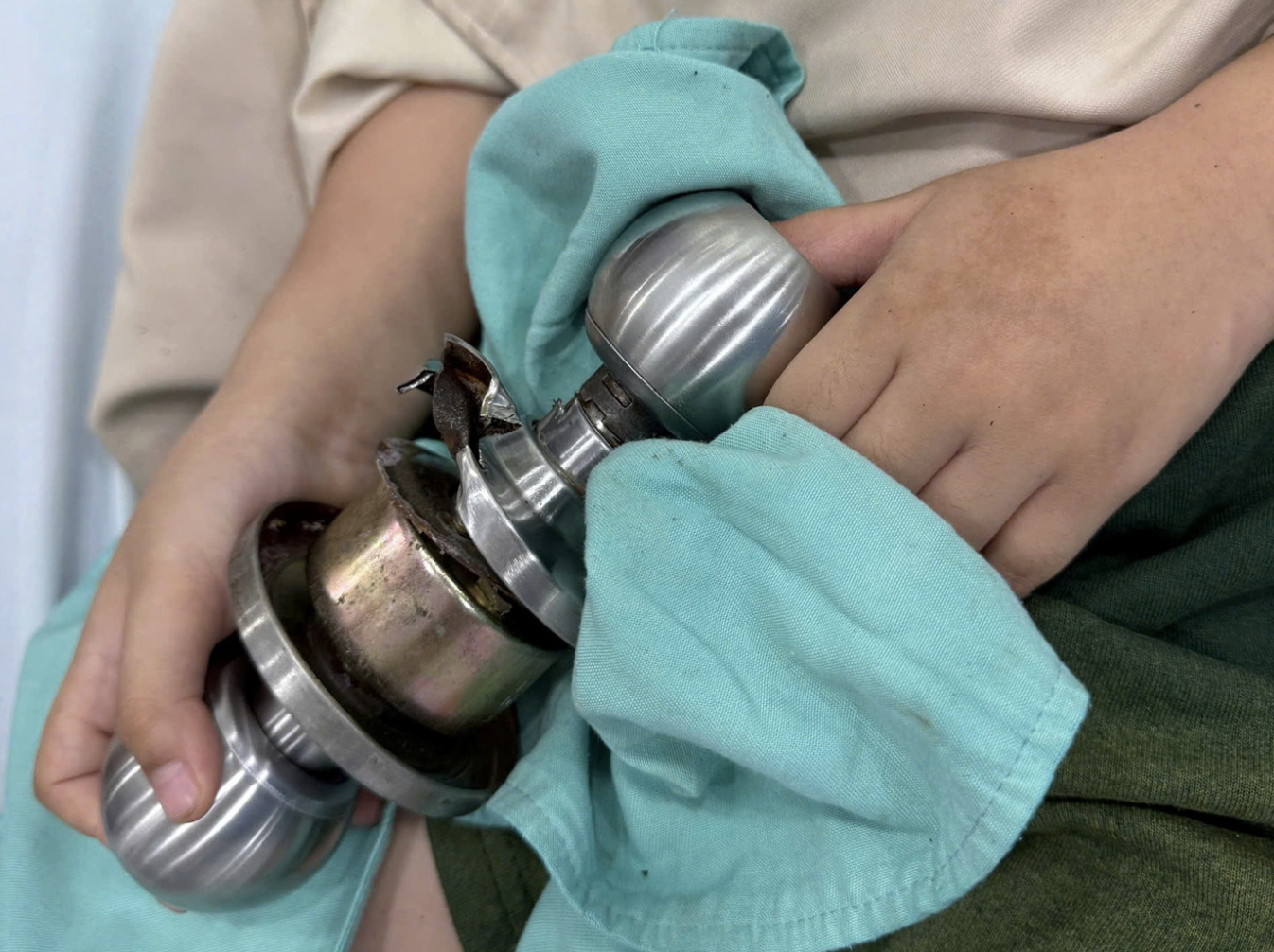 Bé trai 5 tuổi ‘ôm’ ổ khóa nhập viện cấp cứu: Bác sĩ cảnh báo tai nạn sinh hoạt nguy hiểm